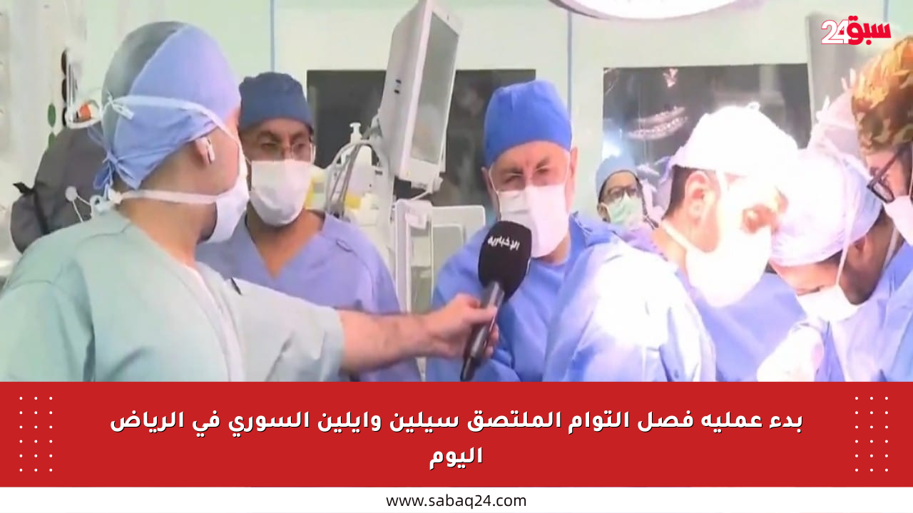 بدء عملية فصل التوأم الملتصق سيلين وإيلين السوري في الرياض اليوم